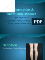 Varicose & LL. Ischemia