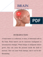 Brain Tumor