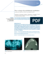 Prise en Charge D'un Améloblastome Mandibulaire - Copie