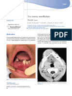 Une Tumeur Mandibulaire