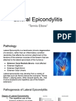 Lateral Epicondylitis