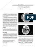 Tratamiento Con Valproato y Complicación Hemorrágica Cerebral