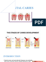 Dental Caries