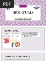 Hematuria Edward