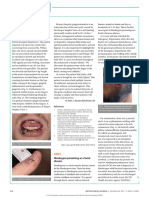 Oral Diseases: Primary Gingivostomatitis and Herpetic Whitlow