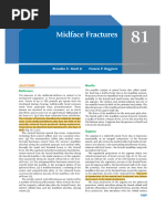 Midfacial Fracture:ZMC Fracture