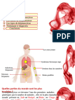 Drépanocytose