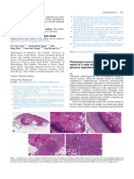 Pilomatrical Carcinosarcoma Report of A Case With