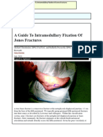 A - A Guide To Intramedullary Fixation of Jones Fractures