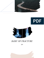 Basic Fracture