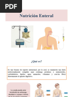 Nutrición Enteral