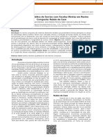 Harmonização Estética Do Sorriso Com Facetas Diretas em Resina Composta: Relato de Caso