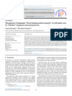 Management of Impinging "Nickel Titanium Palatal Expander" in Cleft Palate Cases by "Soft Flow" (Temporary Mucosal Protector)