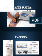 Diatermia