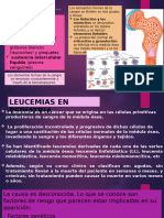 Leucemia en Pediatria - 1