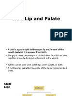 Cleft Lip and Palate