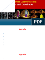 Quantification of LV Volumes