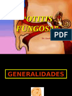 Otitis Fungosa III1