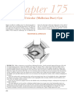 Chapter175 ExcisionofUtricular (MullerianDuct) Cyst