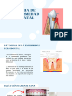 Patogenia de La Enfermedad Periodontal