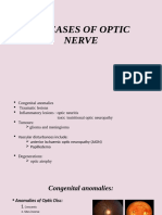 Diseases of Optic Nerve