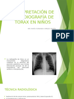 Interpretación de La Radiografía de Tórax en Niños