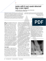 Maxillary First Molar With 8 Root Canals Detected by CBCT Scanning: A Case Repor