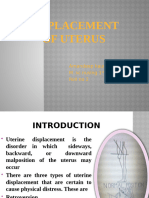 Displacement of Uterus