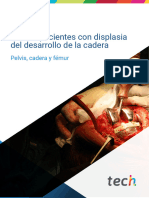 PTC en Pacientes Con Displasia Del Desarrollo de La Cadera