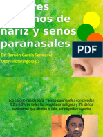 Tumores Malignos de Nariz y Senos Paranasales