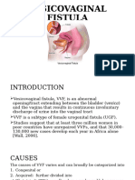 Vesicovaginal Fistula