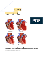 Cardiomyopathy