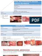 Estomatitis Aftosa /Rau/Periadenitis Mucosa Necrotica Recurrente