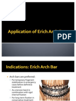 Application of Erich Arch Bar