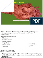 Carcinoma Colon