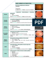 Signes Visibles Au Fond D'œil