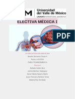 Tarea de Tromboembolia