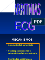 Arritmias Parte 1