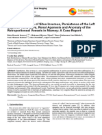 34 - Imaging Diagnosis of Situs Inversus, Persistence of The Left