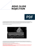 Cardio Slide Projection