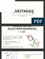 ARRITMIAS