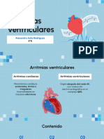 Arritmias Ventriculares