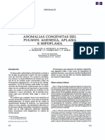 Anomalías Congenitas Del Pulmón: Agenesia, Aplasia E Hipoplasia