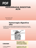 HEMORRAGIA DIGESTIVA ALTA Jesus Morales