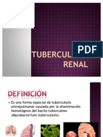 Tuberculosis Renal 1