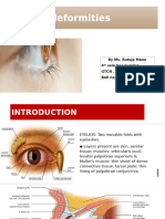 Eyelid Deformities - Adult Health Nursing