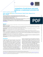 Three Dimensional Comparison of Toothborne