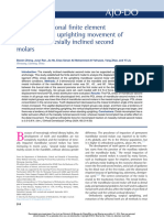 Three-Dimensional Nite Element Analysis of The Uprighting Movement of Mandibular Mesially Inclined Second Molars