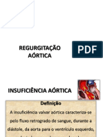 Insuficiencia Aortica