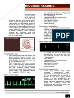 Electrocardiogram Reading